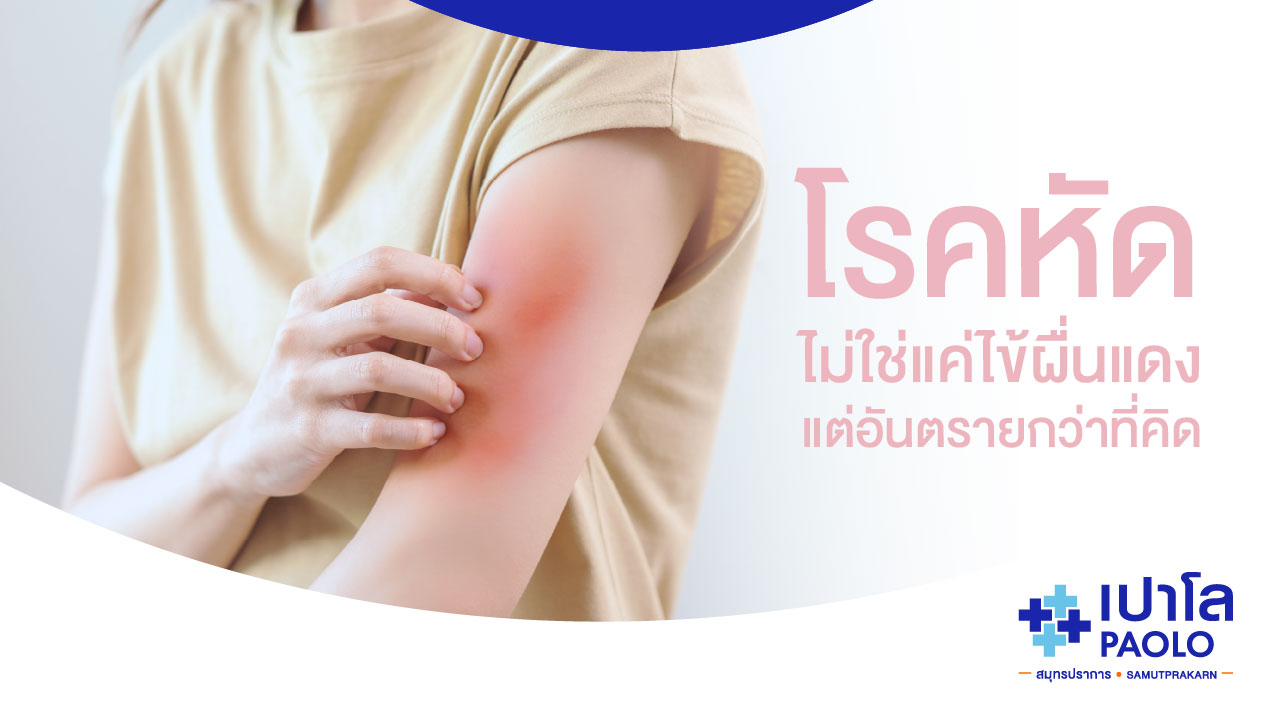 โรคหัด ไม่ใช่แค่ไข้ผื่นแดง แต่อันตรายกว่าที่คิด!